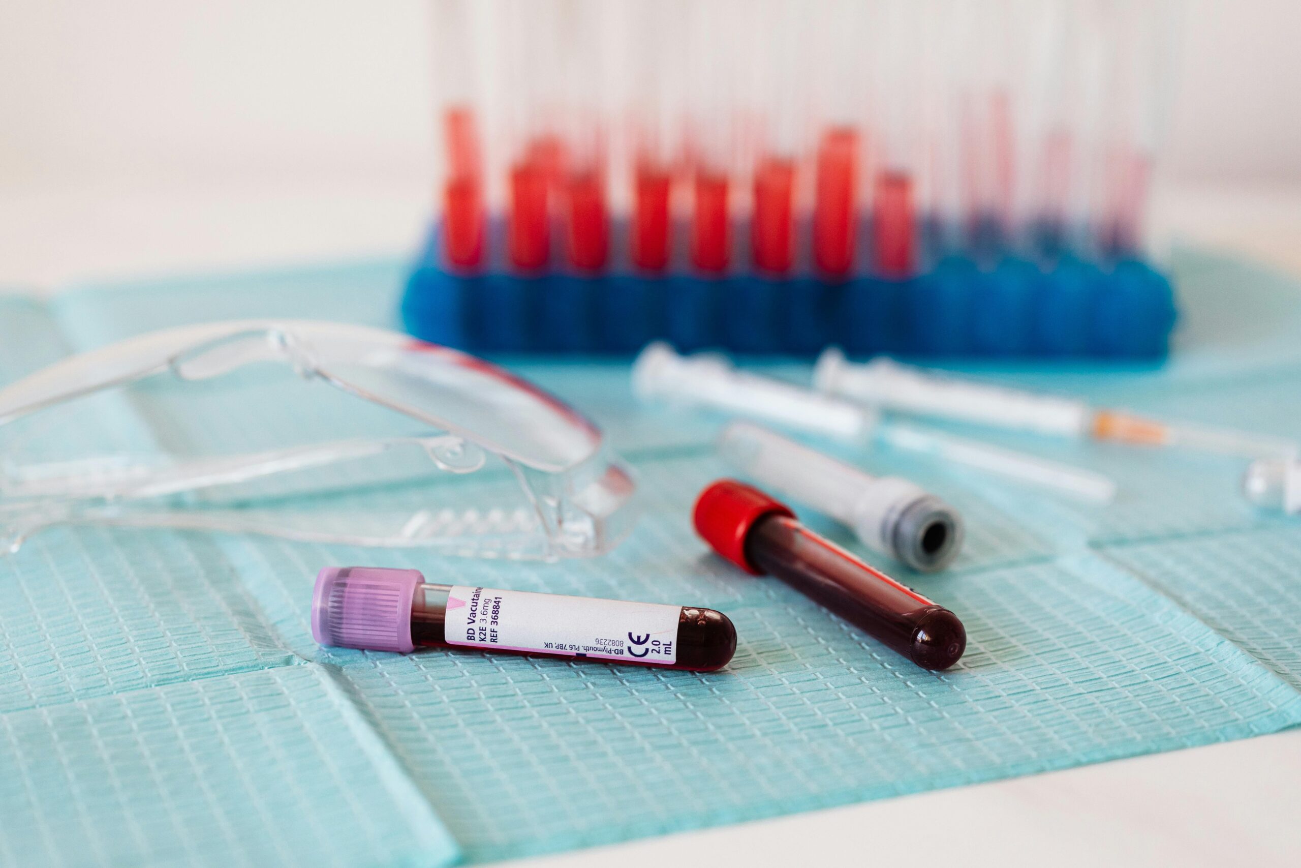 Closeup of full vials of blood placed on medical diaper near plastic eyeglasses and syringes and test tubes in container